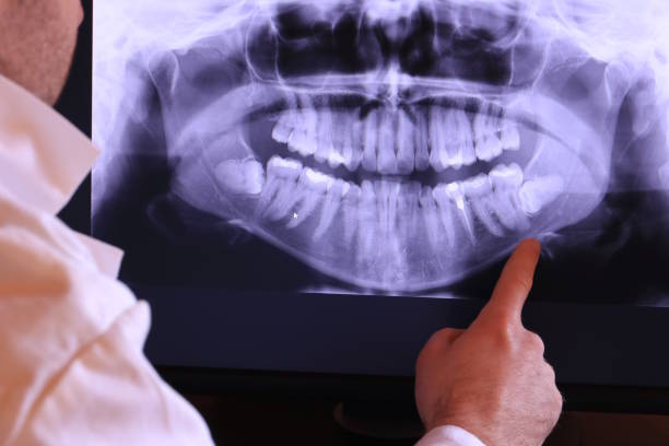 Best Emergency Gum Treatment in Athens, AL
